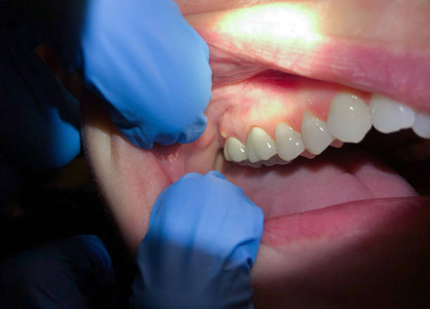 Best Emergency Denture Repair in Congress, AZ